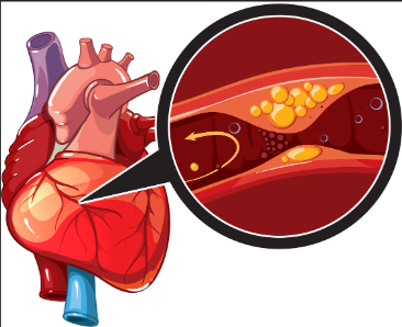 heart diseases